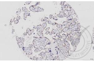 Immunohistochemistry (IHC) image for anti-Mitogen-Activated Protein Kinase Kinase 1 (MAP2K1) (AA 2-150) antibody (ABIN686482)