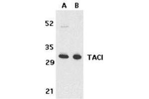 Western blot analysis of TACI in K562 (A) and U937 (B) cell lysates with this product at 5 μg/ml. (TACI 抗体  (N-Term))