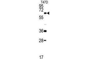 Western blot analysis of DDX5 antibody (C-term) in T47D cell line lysates (35ug/lane). (DDX5 抗体  (C-Term))