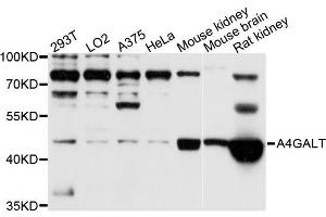 Western blot analysis of extracts of various cell lines, using A4GALT antibody (ABIN5995923) at 1/1000 dilution. (A4GALT 抗体)