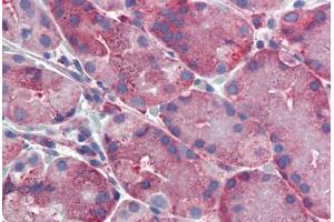 Human, Stomach: Formalin-Fixed Paraffin-Embedded (FFPE) (ERP44 抗体  (C-Term))