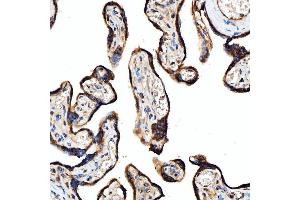 IHC analysis of SRPRB using anti-SRPRB antibody (ABIN7602015). (SRPRB 抗体  (AA 55-271))