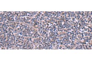 Immunohistochemistry of paraffin-embedded Human tonsil tissue using RIC3 Polyclonal Antibody at dilution of 1:90(x200) (RIC3 抗体)