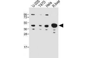 All lanes : Anti-IDAS Antibody (N-term) at 1:1000 dilution Lane 1: U-20S whole cell lysate Lane 2: T47D whole cell lysate Lane 3: Hela whole cell lysate Lane 4: Rat liver whole cell lysate Lysates/proteins at 20 μg per lane. (Multicilin 抗体  (N-Term))