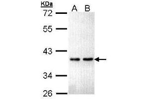 WB Image Sample (30 ug of whole cell lysate) A: Hela B: Hep G2 , 12% SDS PAGE antibody diluted at 1:5000 (ZNF346 抗体)