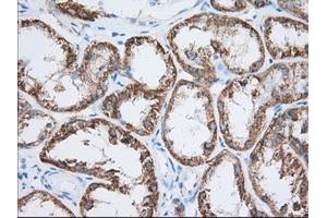 Immunohistochemical staining of paraffin-embedded Human Kidney tissue using anti-HIBCH mouse monoclonal antibody. (HIBCH 抗体)
