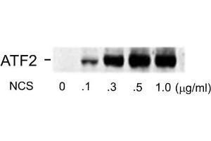 Western blots of human melanoma cells incubated with varying doses of the radiomimetic drug NCS showing specific immuno-labeling of the ~74k ATF2 protein phosphorylated at Ser490 and Ser498. (ATF2 抗体  (pSer490, pSer498))