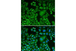 Immunofluorescence analysis of HeLa cells using ACTR3 antibody (ABIN5970423). (ACTR3 抗体)