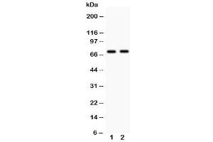 Western blot testing with MEKK3 antibody Lane 1: rat brain (MAP3K3 抗体  (N-Term))
