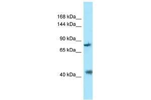 WB Suggested Anti-PACS1 Antibody Titration: 1. (PACS1 抗体  (C-Term))