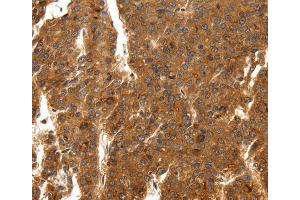 Immunohistochemistry (IHC) image for anti-Sodium Channel, Voltage-Gated, Type XI, alpha Subunit (SCN11A) antibody (ABIN2432261) (SCN11A 抗体)