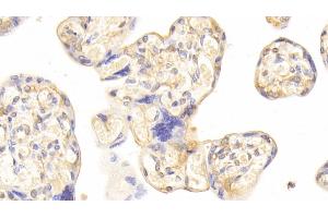 Immunohistochemistry (IHC) image for anti-Cysteine Dioxygenase, Type I (CDO1) (AA 1-200) antibody (ABIN7443176)