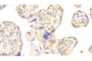 Detection of CDO1 in Human Placenta Tissue using Polyclonal Antibody to Cysteine Dioxygenase I (CDO1) (CDO1 抗体  (AA 1-200))