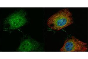ICC/IF Image T-Plastin antibody detects T-Plastin protein at cytoplasm and nucleus by immunofluorescent analysis. (Plastin 3 抗体)