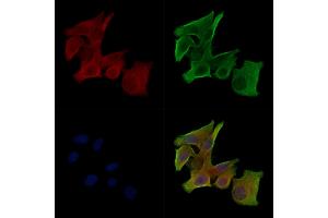Phospho-RYR2 (Ser2030) Antibody staining HepG2 cells(serum starvation treatment) by IF/ICC.
