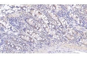 Detection of IL17 in Human Small intestine Tissue using Monoclonal Antibody to Interleukin 17 (IL17) (IL-17 抗体  (AA 20-155))