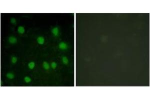 Immunofluorescence analysis of HuvEc cells, using Dematin (Ab-403) Antibody.