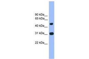 Image no. 1 for anti-Family with Sequence Similarity 13, Member C (FAM13C) (AA 81-130) antibody (ABIN6745285) (FAM13C 抗体  (AA 81-130))