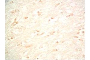 Rat brain tissue was stained by Rabbit Anti-Metasin (1-25) / KISS-1 (68-92) (Human) Serum (KISS1 抗体  (AA 1-25, AA 68-92))
