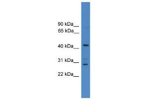 WB Suggested Anti-ARMC8 Antibody Titration: 0. (ARMC8 抗体  (N-Term))