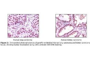Image no. 1 for anti-Lysine (K)-Specific Demethylase 1A (KDM1A) antibody (ABIN207611) (LSD1 抗体)