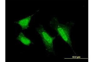 Immunofluorescence of monoclonal antibody to PRKCI on HeLa cell.