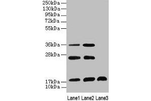Western Blot All lanes: SFT2D2 antibody at 8 μg/mL Lane 1: Mouse liver tissue Lane 2: Mouse kidney tissue Lane 3: Mouse thymus tissue Secondary Goat polyclonal to rabbit IgG at 1/10000 dilution Predicted band size: 18 kDa Observed band size: 18, 26, 36 kDa