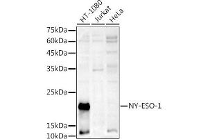 Western blot analysis of extracts of various cell lines, using NY-ESO-1 antibody (ABIN6129965, ABIN6139172, ABIN6139173 and ABIN6225112) at 1:1000 dilution. (CTAG1B 抗体  (AA 1-180))