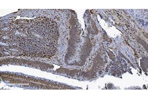 IHC analysis of SAMHD1 using anti-SAMHD1 antibody (ABIN7601514).