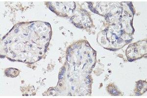 Immunohistochemistry of paraffin-embedded Human placenta using TrkB Polyclonal Antibody at dilution of 1:200 (40x lens). (TRKB 抗体)