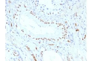 Formalin-fixed, paraffin-embedded Human Testis stained with Wilm's Tumor Mouse Monoclonal Antibody (WT1/857). (WT1 抗体)