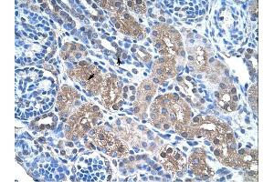 FBP1 antibody was used for immunohistochemistry at a concentration of 4-8 ug/ml. (FBP1 抗体  (N-Term))
