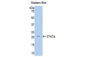 Western Blotting (WB) image for anti-Collagen, Type VIII, alpha 2 (COL8A2) (AA 533-698) antibody (ABIN1176005) (COL8a2 抗体  (AA 533-698))
