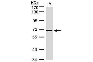 Western Blotting (WB) image for anti-Activin A Receptor Type II-Like 1 (ACVRL1) (Internal Region) antibody (ABIN2855228)