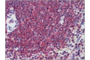 Human Spleen: Formalin-Fixed, Paraffin-Embedded (FFPE) (CA1 抗体  (Internal Region))