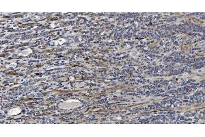 IHC analysis of Alpha B Crystallin/CRYAB using anti-Alpha B Crystallin/CRYAB antibody (ABIN7601209).