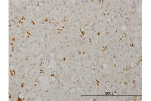 Immunoperoxidase of monoclonal antibody to SMG1 on formalin-fixed paraffin-embedded human adrenal gland. (SMG1 抗体  (AA 2922-3031))