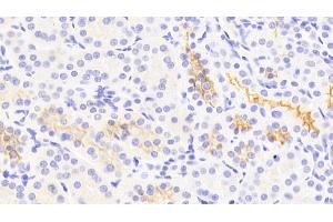 Detection of Kim1 in Human Kidney Tissue using Polyclonal Antibody to Kidney Injury Molecule 1 (Kim1) (HAVCR1 抗体  (AA 21-240))