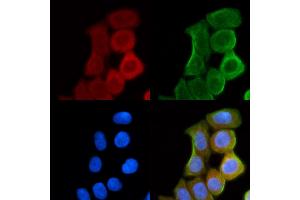 ABIN6261569 and ABIN6268794 staining Hela cells(30 min of UV treatment) by IF/ICC.