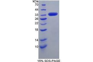 SDS-PAGE (SDS) image for Low Density Lipoprotein Receptor-Related Protein 1 (LRP1) (AA 692-962) protein (His tag) (ABIN1879118) (LRP1 Protein (AA 692-962) (His tag))