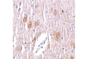 Immunohistochemistry of TRIM5 delta in mouse brain tissue with this product at 1 μg/ml. (TRIM5 抗体  (C-Term, Isoform delta))