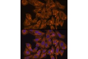 Immunofluorescence analysis of U-2 OS cells using J Rabbit pAb (ABIN7268038) at dilution of 1:100 (40x lens). (JAK1 抗体  (AA 120-380))