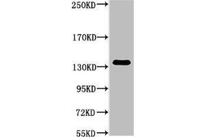 Western blot analysis of Hela, diluted at 1:1000. (COL3A1 抗体)