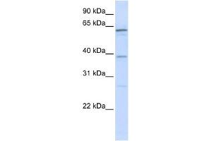 RBM39 antibody used at 1 ug/ml to detect target protein.