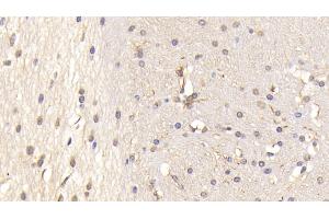 Immunohistochemistry (IHC) image for anti-Protein tyrosine Phosphatase, Receptor Type, S (PTPRS) (AA 889-1102) antibody (ABIN7440173)