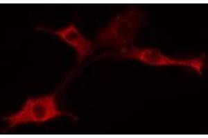 ABIN6275358 staining 293 cells by IF/ICC. (PIGX 抗体  (Internal Region))