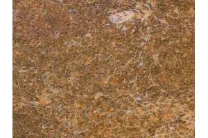 ABIN6257590 and ABIN6274935 at 1/100 staining Mouse spleen tissue by IHC-P. (CHP 抗体  (Internal Region))