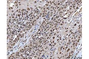 IHC analysis of XRCC4 using anti-XRCC4 antibody (ABIN7599168).