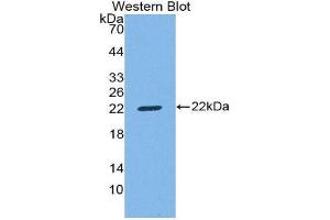 Western Blotting (WB) image for anti-CD8b Molecule (CD8B) (AA 22-175) antibody (ABIN1858319) (CD8B 抗体  (AA 22-175))
