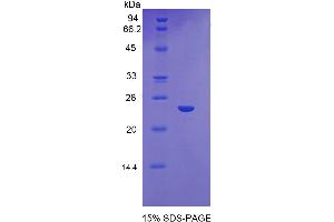 SDS-PAGE analysis of Mouse Glutathione synthetase Protein. (Glutathione Synthetase Protein (GSS))